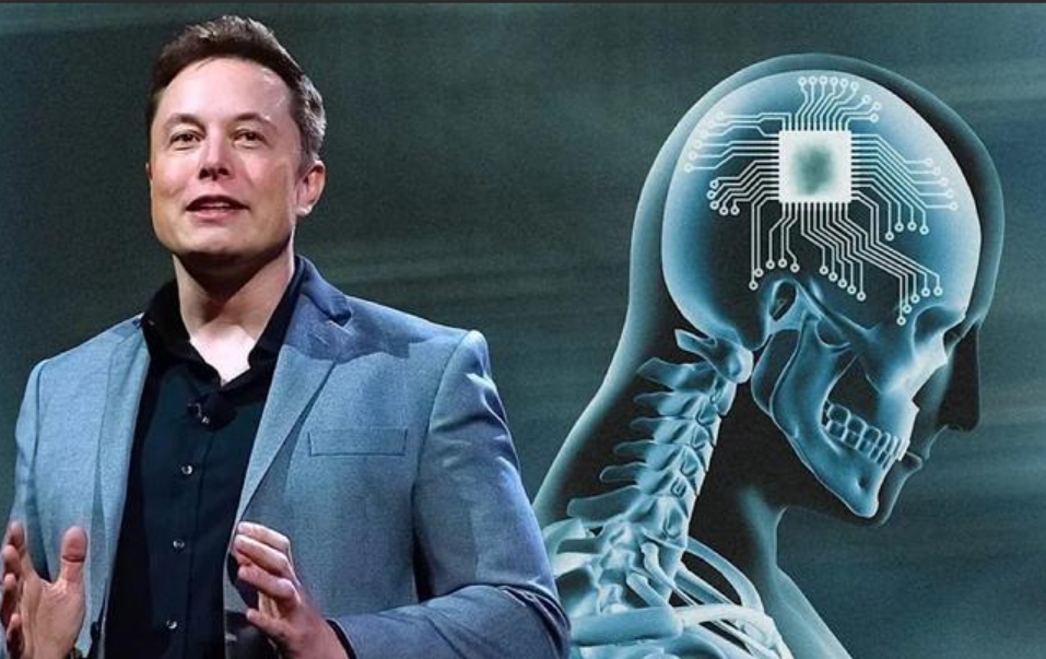 Marx once founded a company that researched monkey brain interfaces